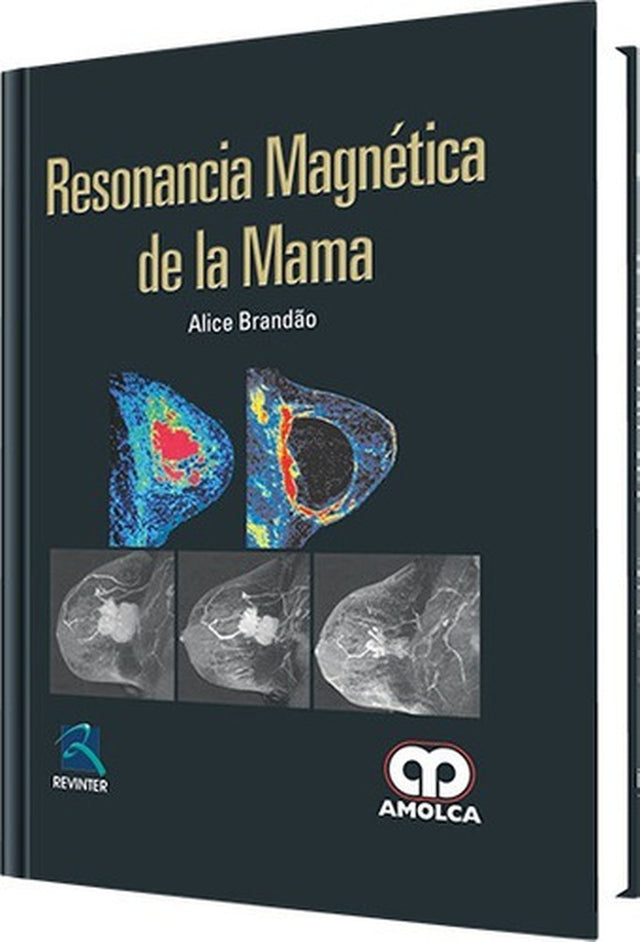 Alice Brandão. Resonancia Magnética de la Mama. 1ra ed. 2012