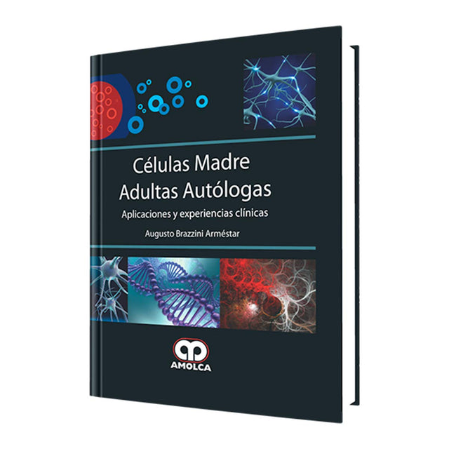 Augusto Brazzini Arméstar. Células Madre Adultas Autólogas. 1ra ed. 2015