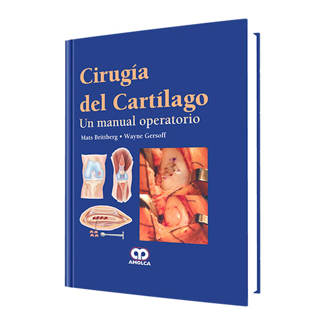 Mats Brittberg. Cirugía del Cartílago. 1ra ed. 2012