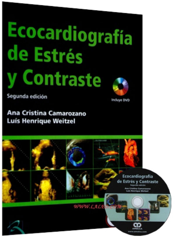 Ana Cristina Camarozano. Ecocardiografía de Estrés y de Contraste. 2da ed. 2015