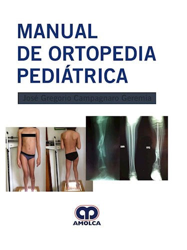 José Gregorio Campagnaro. Manual de Ortopedia Pedriátrica. 1ra ed. 2019