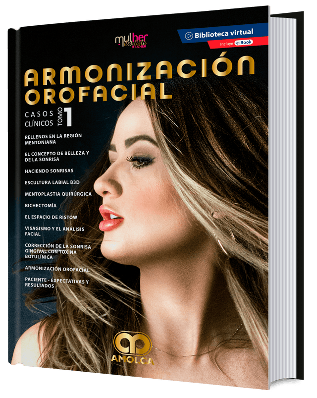 Ana Carbone. Armonización Orofacial. Casos Clínicos. Tomo 1. E-Book. 1a. ed. 2020