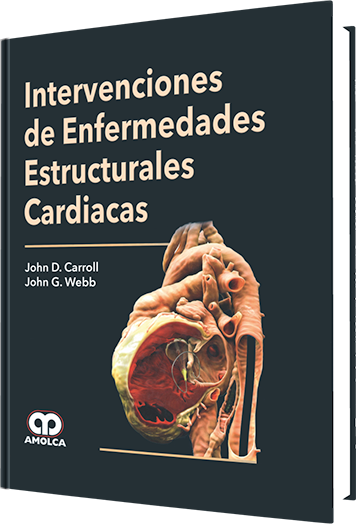 John D. Carroll. Intervenciones de Enfermedades Estructurales Cardiácas. 1ra ed. 2015