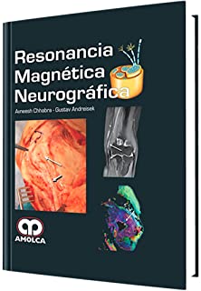 Avneesh Chhabra, MD Resonancia Magnética Neurográfica 1ra ed 2014