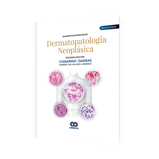 David Cassarino. Dermatopatología Neoplásica. Segunda Edición. Incluye E-book. 2da ed. 2019
