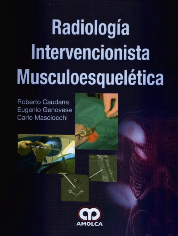 Roberto Caudana. Radiología Intervencionista Musculoesquelética. 1ra ed. 2012