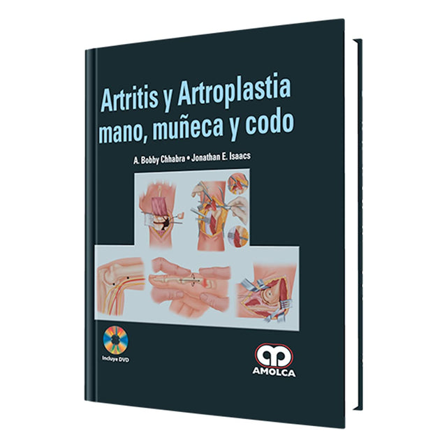 A. Bobby Chhabra, MD. Artritis y Artrosplastia Mano, Muñeca y Codo. 1a. ed. 2012