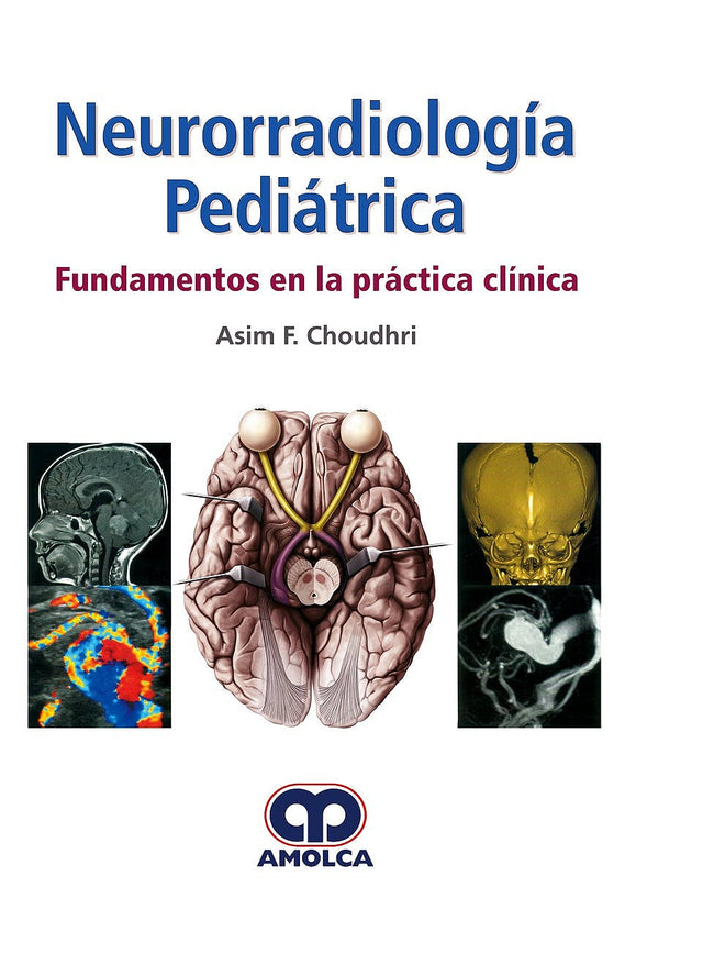 Asim F. Choudhri, MD. Neurorradiología Pediatríca. Fundamentos en la Práctica Clínica. 1ra ed. 2018