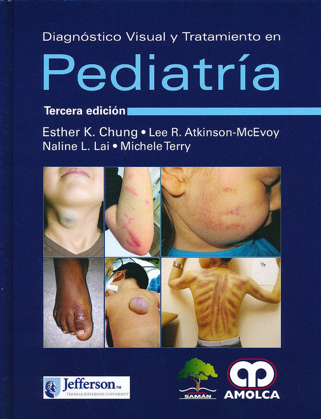 Esther K. Chung. Diagnóstico Visual y Tratamiento en Pediatría. 3ra ed. 2016