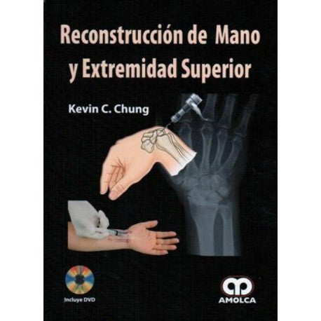 Kevin C. Chung. Reconstrucción de Mano y Extremidad Superior. 1ra ed. 2011