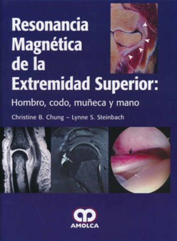 Christine B. Chung, MD. Resonancia Magnética de la Extremidad Superior. 1ra ed. 2014