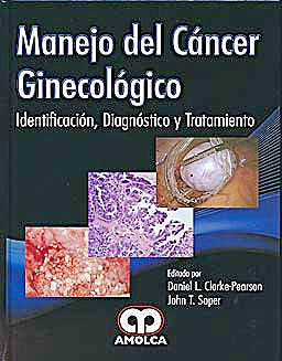 Daniel L. Clarke-Pearson. Manejo del Cáncer Ginecológico. 1ra ed. 2011