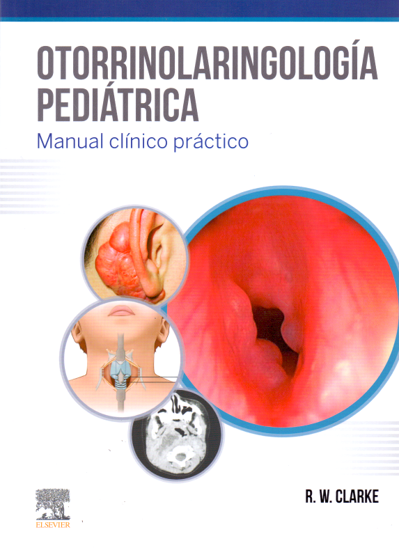Clarke. R.W., Otorrinolaringología pediátrica © 2019