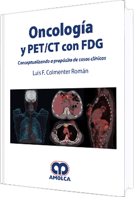 Luis Felipe Colmenter Román. Oncología Y PET/ CT con FDG. 1ra ed. 2018