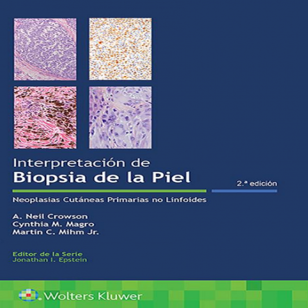 Crowson Neil. Interpretación de biopsia de la piel. 2a. ed. 2020
