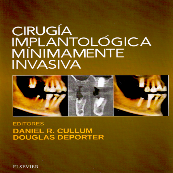 Cullum, D. R., Cirugía implantológica mínimamente invasiva © 2017