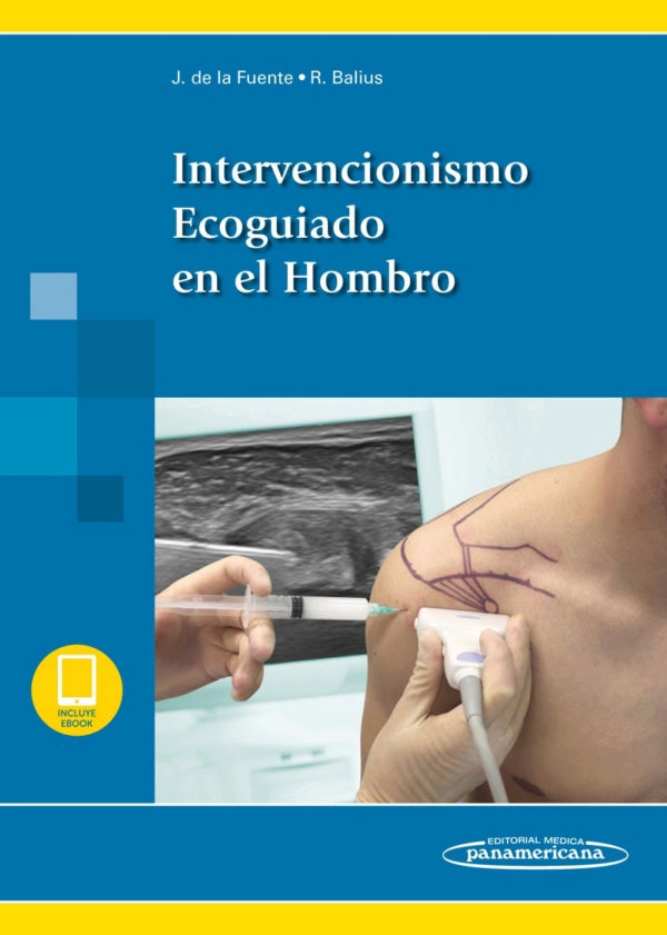 De la Fuente. Ortiz Intervencionismo Ecoguiado en el Hombro. 1a ed.  2019