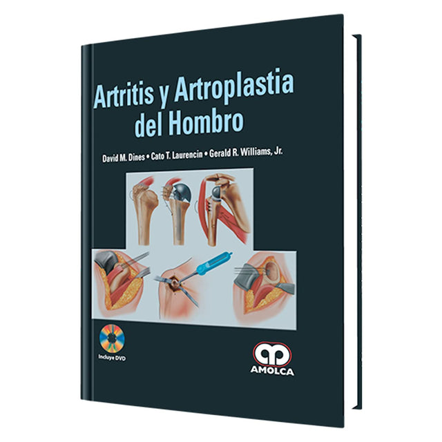 David M. Dines. Artritis y Artrosplastia del Hombro. Incluye DVD. 1a. ed. 2012