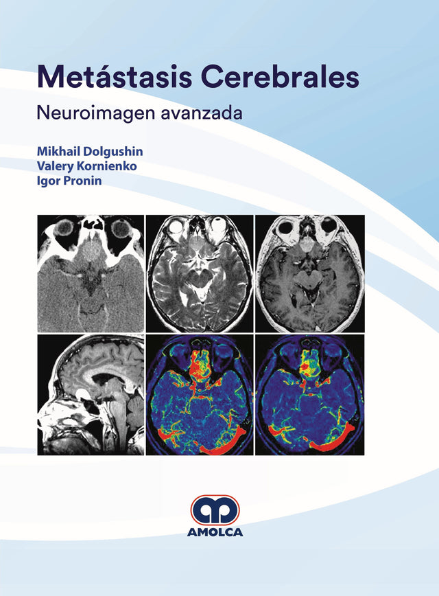 Mikhail Dolgushin. Metástasis Cerebrales. Neuroimagen avanzada. 1ra ed. 2019