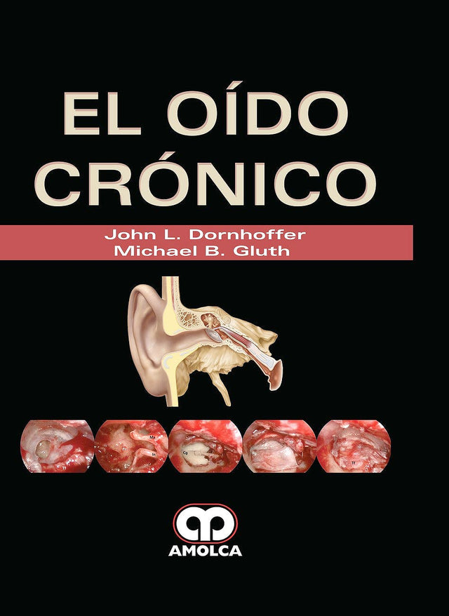 John L. Dornhoffer. El Oído Cronico. 1ra ed. 2018
