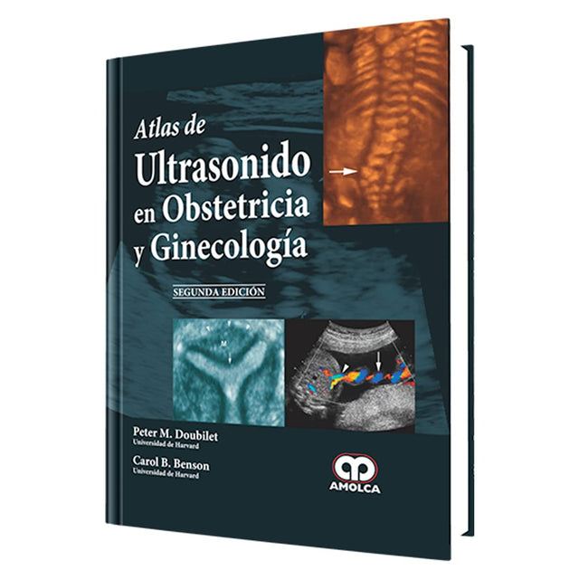 Peter M. Doubilet. Atlas de Ultrasonido en Obstetricia y Ginecología.  2da ed. 2013