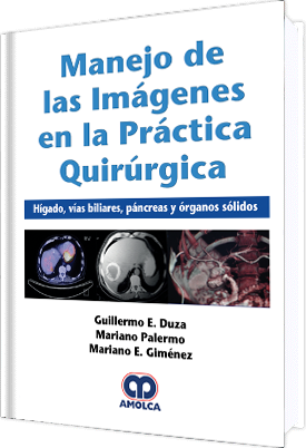 Guillermo E. Duza. Manejo de las Imágenes en la Práctica Quirurgica. Hígado, Vías Biliares, Páncreas y Órganos Sólidos. 1a. ed. 2018