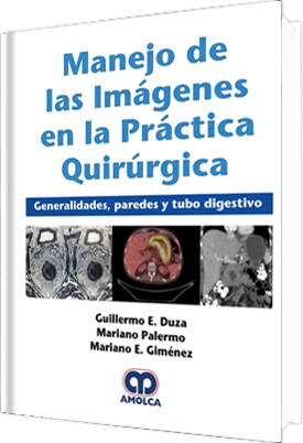 Guillermo E. Duza. Manejo de las Imágenes en la Práctica Quirúrgica. Generalidades, paredes y tubo digestivo. 1a. ed. 2018