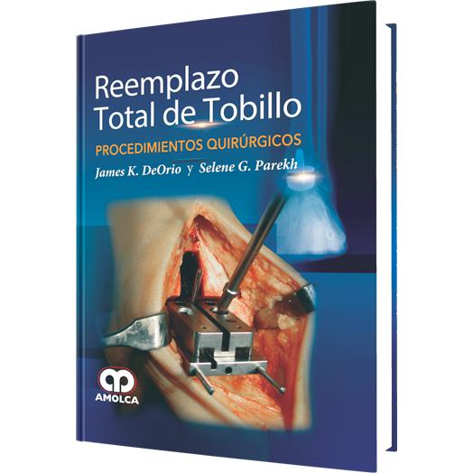 James K. DeOrio. Reemplazo Total de Tobillo. Procedimientos Quirúrgicos. 1ra ed. 2016
