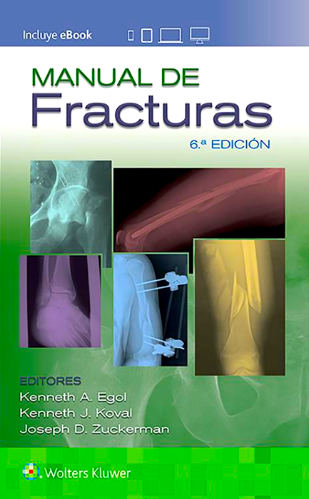 Egol A. Kenneth. Manual de fracturas. 6a. ed. 2020
