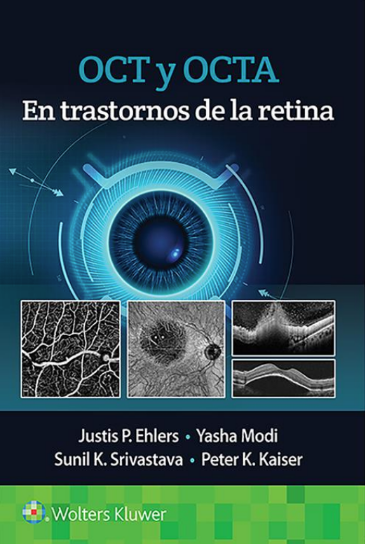 Ehlers P. Justis. OCT y angiografía de  OCT en trastornos de la retina. 1a. ed. 2021