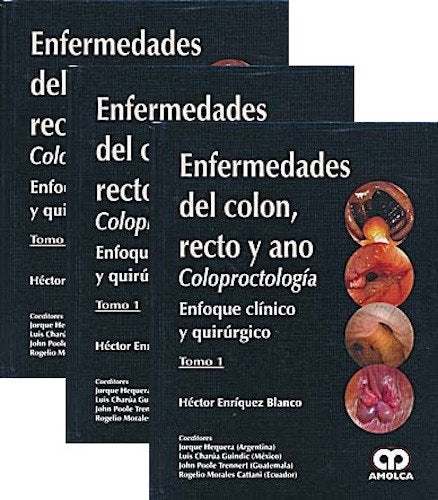 Héctor Enríquez Blanco. Enfermedades del Colón, Recto y Ano. Tomos I - II - III. 1a. ed. 2013