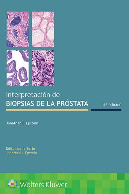 Epstein I. Jonathan. Interpretación de biopsias de la próstata. 6a. ed. 2021