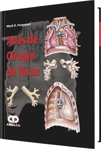 Mark K. Ferguson. Atlas de Cirugía del Tórax. 1a. ed. 2009