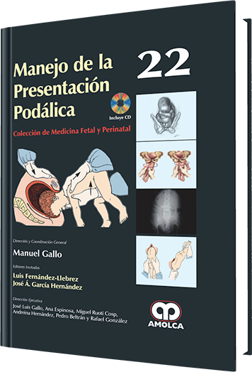 Luis Fernández Llebrez. Manejo de la Presentación Podálica No. 22. Incluye CD