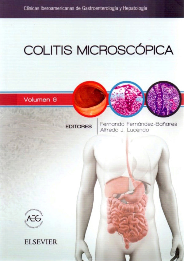 Fernández-Bañares, F., Colitis microscópica © 2016