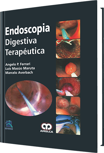Angelo P. Ferrari. Endoscopía Digestiva Terapéutica. 1a. ed. 2013