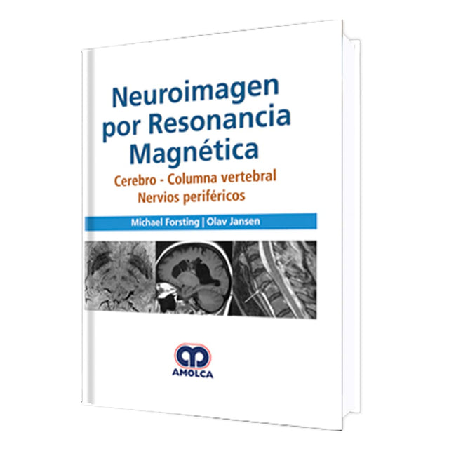 Michael Forsting. Neuroimagen por Resonancia Magnética. Cerebro - Columna Vertebral Nervios periféricos. 1a. ed. 2018