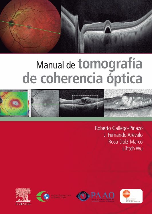 Gallego-Pinazo. Roberto. Manual de tomografía de coherencia óptica. 1a ed. 2022
