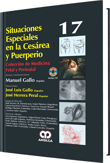 José Luis Gallo. Situaciones Especiales en la Cesárea y Puerperio No. 17. Incluye CD. 1a. ed.