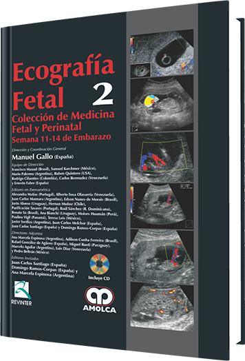 Manuel Gallo Vallejo. Ecografía Fetal  No. 2. Incluye CD. 1a. ed. 2010