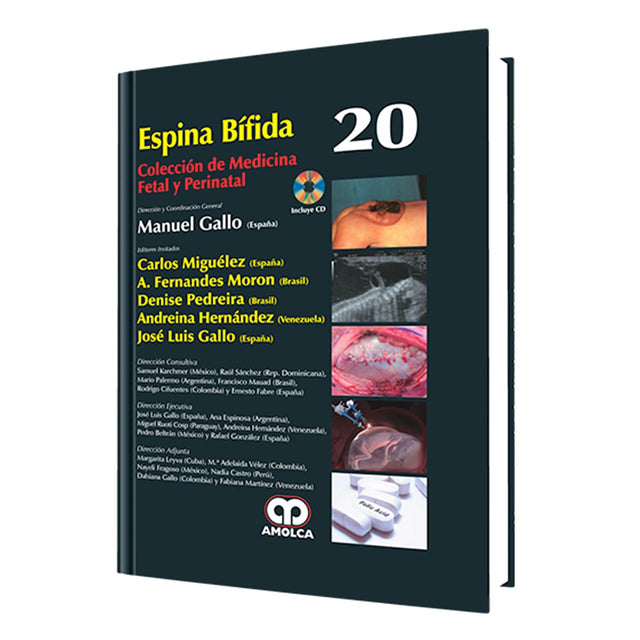 Carlos Miguélez Espina Bífida,  No. 20. Incluye CD 1ra ed 2014