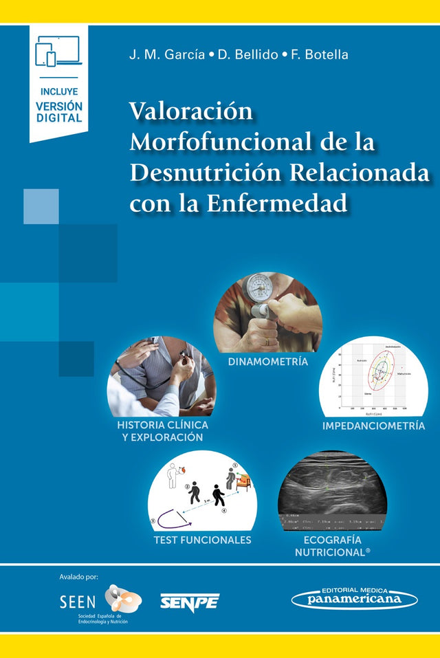 García Almeida. José Manuel. Valoración Morfofuncional de la Desnutrición Relacionada con la Enfermedad. 1a ed. 2022