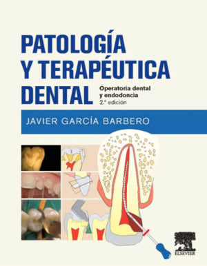 García Barbero, J., Patología y terapéutica dental 2 ed. © 2014