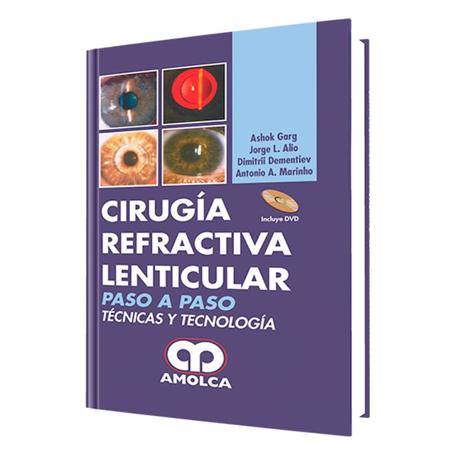 Ashok Garg, MD. Cirugía Refractiva Lenticular. 1a. ed. 2008