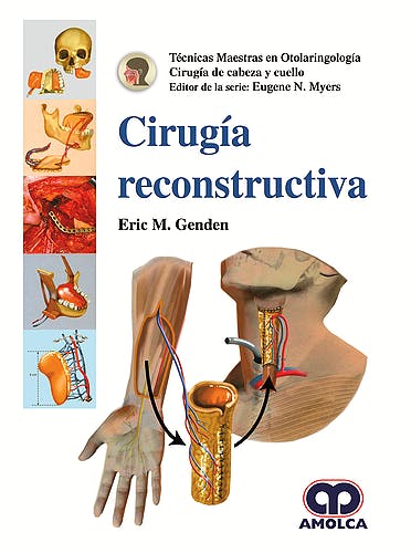 Eric M. Genden. Técnicas Maestras en Otolaringología-Cirugía de Cabeza y Cuello. Cirugía Reconstructiva. 1a. ed. 2018