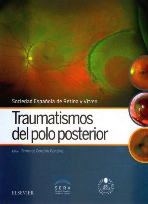 González González. Fernando. Traumatismos del polo posterio 1ra ed. 2016