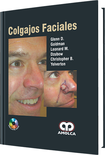 Glenn D. Goldman. Colgajos Faciales.