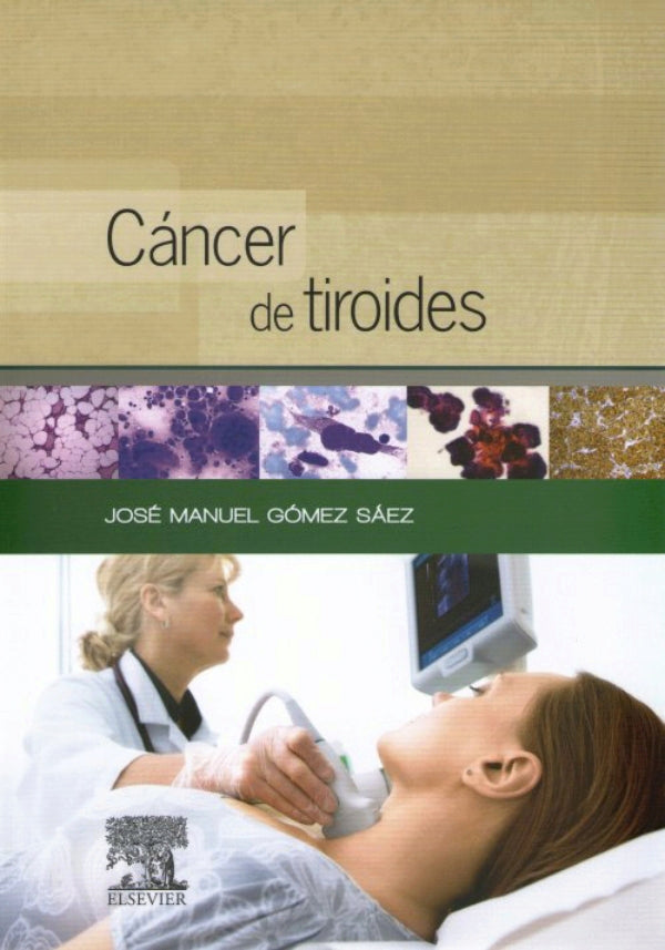 Gómez Sáez, J.M., Cáncer de tiroides © 2014