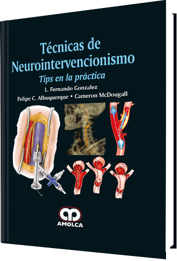 L. Fernando González. Técnicas de Neurointervencionimos. Tips en la Práctica. 1a. ed. 2017