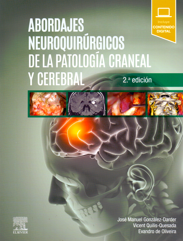 González Darder, J.M., Abordajes neuroquirúrgicos de la patología craneal y cerebral 2 ed. © 2020